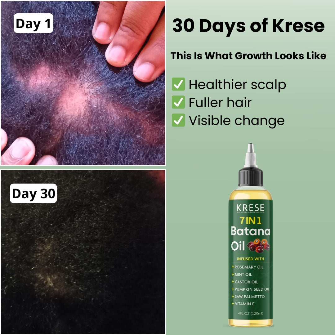 Pure Batana Hair Growth and Repair 7 in 1 Formula