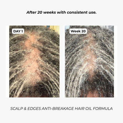 7-in-1 Scalp, Edges & Hairline Restore Formula