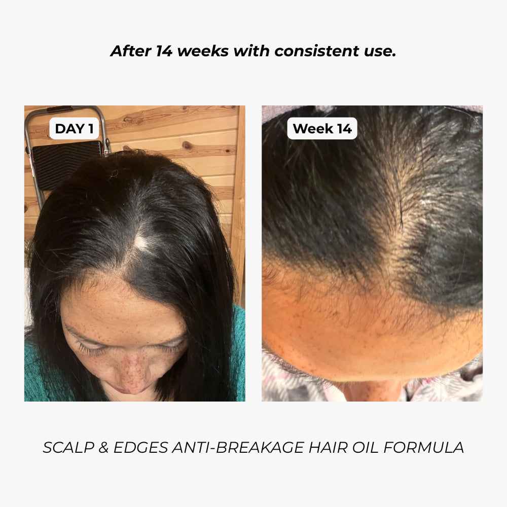 7-in-1 Scalp, Edges & Hairline Restore Formula