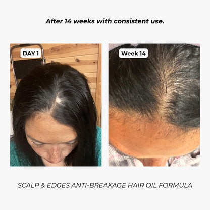 7-in-1 Scalp, Edges & Hairline Restore Formula