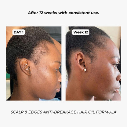7-in-1 Scalp, Edges & Hairline Restore Formula
