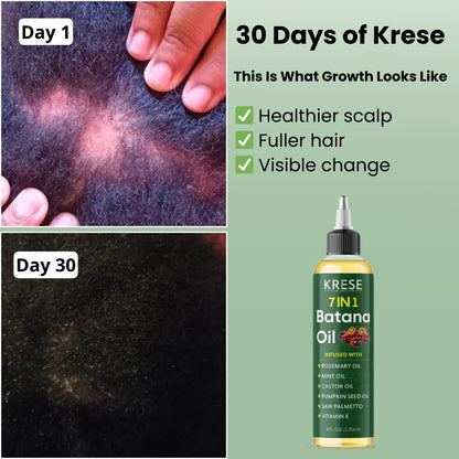 Pure Batana Hair Growth and Repair 7 in 1 Formula